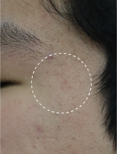 After