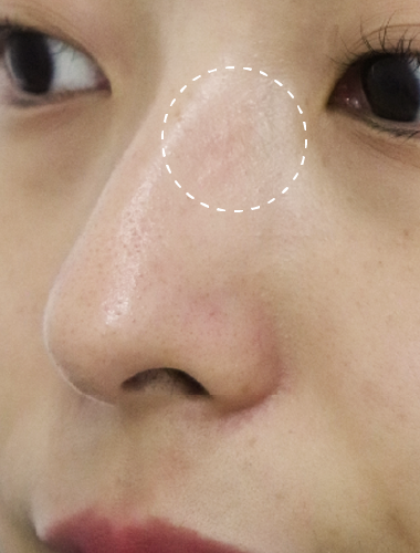 After
