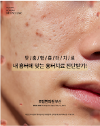 흉터 진단